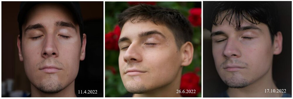 Vitistop gel Gesicht
