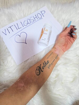 Vitistop tabletten