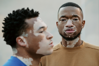 Vitiligo in der Mode: Schönheit in der Vielfalt
